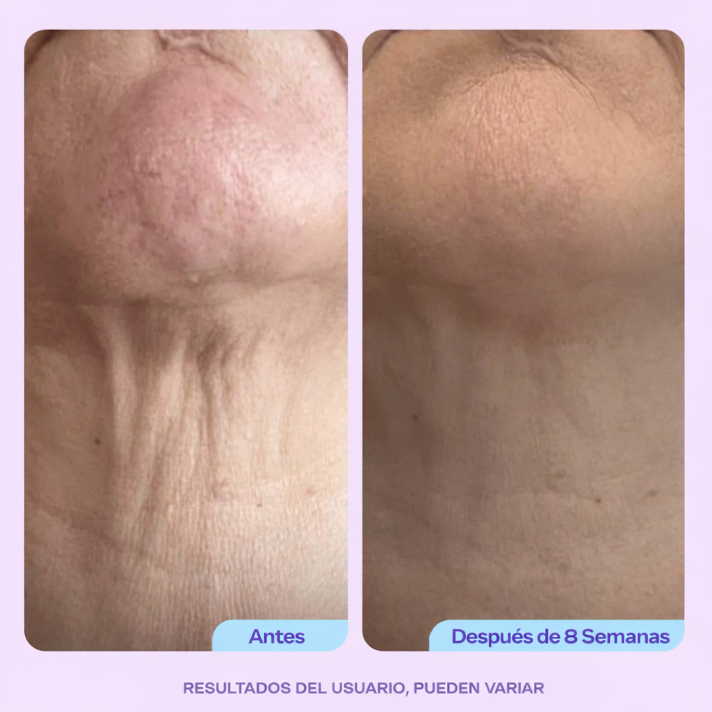 GO PURE; CREMA REAFIRMANTE